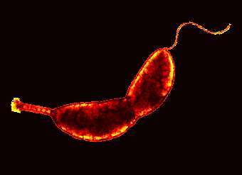 Caulobacter crescentis,    biology.kenyon.edu