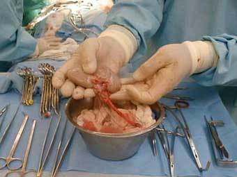 �������� �� ��������� �����. ���� cccinternational.org