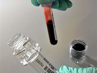 �������������� �����������. ���� &copy;AFP