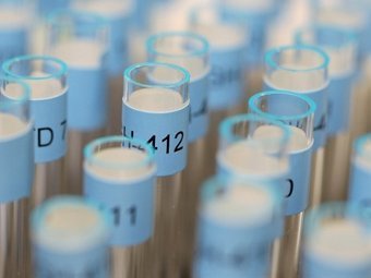 �������������� �����������. ���� &copy;AFP